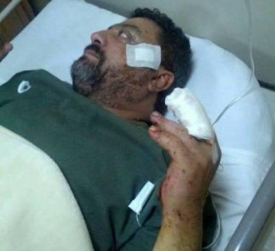 مصدر مقرب من نجل الآنسي: أجريت له عملية لإزالة الشظايا وبتر أصابع قدمه (صورة)