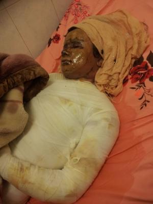 نداء استغاثة: الطفلة فاطمة تناشد فيكم الانسانية انقاذ حياتها 