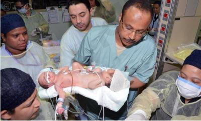 بالصور..وصول «السياميين اليمنيين» عبدالعزيز وعبدالله لمدينة الملك فهد الطبية