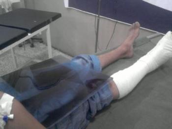 فيديو وصور : شهادات المصابين حول اختطافهم من قبل البلاطجة يوم أمس فيديو وصور : شهادات المصابين حول اختطافهم من قبل البلاطجة يوم أمس
