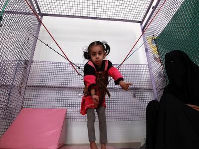  زواج الأقارب في اليمن يبدأ بفرحة... وينتهي بإعاقة 