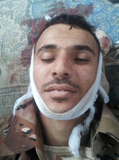 الجيش يرد بقوة على هجوم غادر للحوثي، ويدك معاقلهم في جبل المحشاش ويسيطر على مواقع واسلحة ويأسر 7 من مقاتلي الحوثي