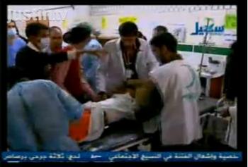 عشرة قتلى .. واكثر من خمسين جريح بينهم 10 حالتهم حرجة في اعتداءات البلاطجة اليوم على مسيرة في خط التلفزيون