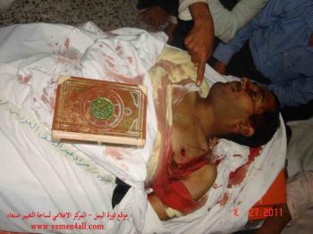 احصائية الأحداث في اليمن (419) قتيل في اليمن و (12800) مصاب و (102) حالة اختطاف حسب منظمة حقوقية