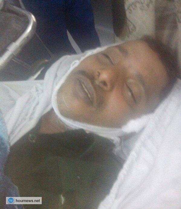 وفاة شخصين من الجامعيين المتقدمين لكلية الشرطة بصنعاء أثناء التدريب (صور + أسماء)