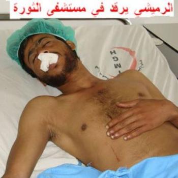 الشاعر الرميشي يرفض اتهام شباب الثورة بقطع لسانه .. والمشترك يدين الجريمة ويطالب بتقديم مرتكبيها للعدالة