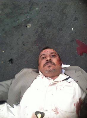 (تفاصيل والصور) أكثر من 30 قتيلاً بينهم 5 أطفال حصيلة أولية للعملية الانتحارية التي استهدفت تجمعاً للحوثيين بميدان التحرير (صور) (تفاصيل والصور) أكثر من 30 قتيلاً بينهم 5 أطفال حصيلة أولية للعملية الانتحارية التي استهدفت تجمعاً للحوثيين بميدان التحرير (صور)