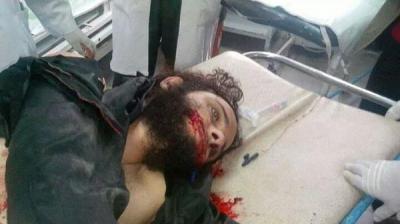 هدد بأن دم قريبه لن يذهب هدراً: أحد أقارب القتيل الصيدلاني الذي قتل على يد الحوثي يطالب جماعة الحوثي المسلحة بتسليم الجناة