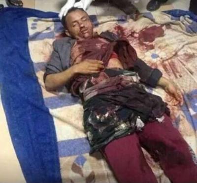 مسلحو الحوثي يقتلون شاب في محافظة إب داخل منزله وتحت أنظاراسرته 