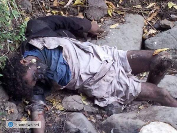 إب: البحث الجنائي يسحب جثة مجهول لتشريحها في قرية الشراعي بجبلة (صورة جديدة)