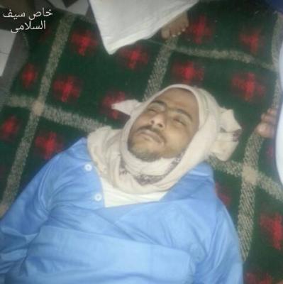 وفاة أحد المختطفين لدى جماعة الحوثي بعد تعرضه للتعذيب الشديد - صور 