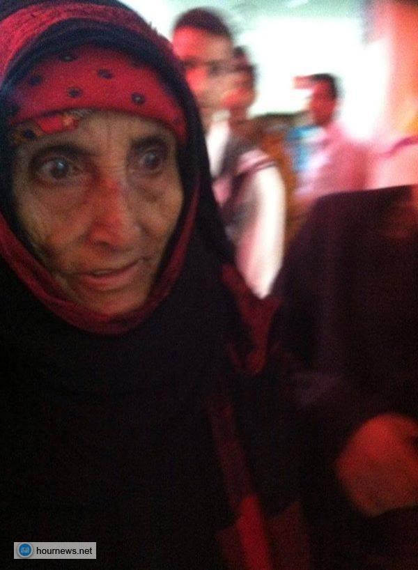 لم يرحموا ضعفها ولا عجزها، جماعة الحوثي بإب تصيب امرأة طاعنة بالسن بعدة إصابات (صورة)