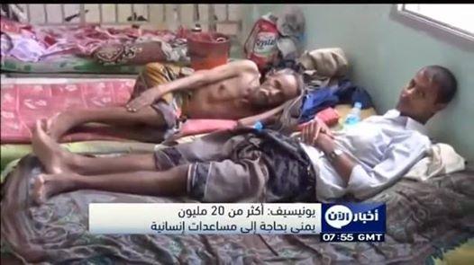 يونيسيف: أكثر من 20 مليون يمني بحاجة إلى مساعدات إنسانية (فيديو)