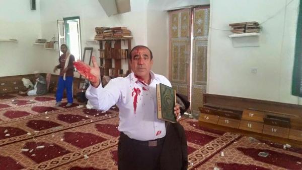 كاتب يروي لحظات انفجار سيارة مفخخة وضعت بجوار مسجد قبة المهدي بصنعاء القديمة