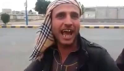 أقوى قصيدة شعرية يشارك بها سائق دراجة نارية تصف الوضع الحالي باليمن (فيديو)