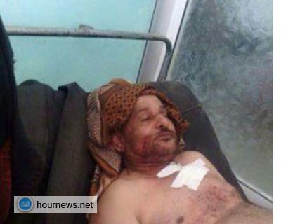صورة القيادي في المقاومة علي عبدالله البعني بعد إصابته في اشتباكات منطقة مشورة