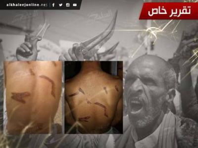 "ضرار" يروي تفاصيل اعتقاله وتعذيبه منذ البداية وحتى رميه بأحد أرصفة صنعاء من قبل الحوثيين