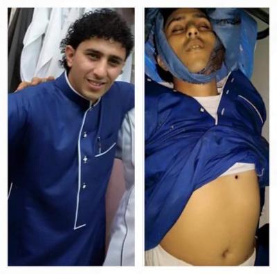 مقتل الفنان اليمني نادر الجرادي بصنعاء "صورة"