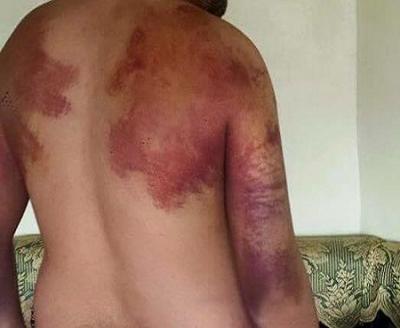 شهادات مروعة عن التعذيب في أحد سجون الحوثيين