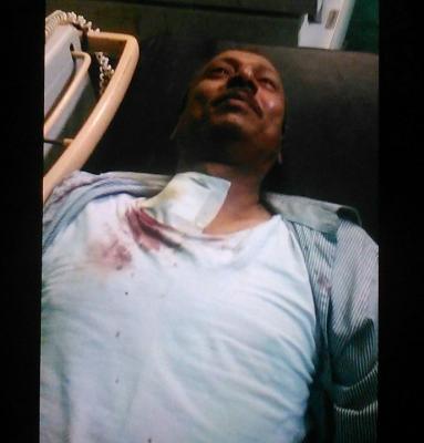 عاجل: شاهد أول صورة للعقيد شايع بعد مقتله في اشتباكات بعدن