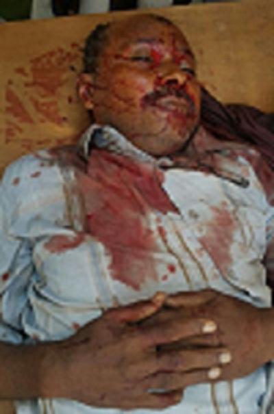 مسلح على متن دراجة نارية يقتل عاقل سوق الحراج ويصيب آخر في باب مشرف بالحديدة (صورة)
