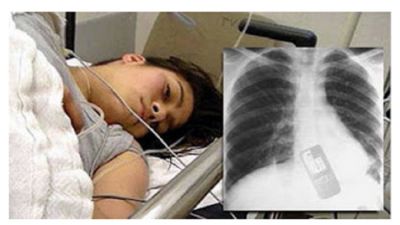 مراهقة تبتلع هاتفها الجوال والسبب ... !
