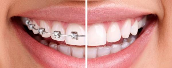 طب تقويم الأسنان ومراحل تطوره في اليمن