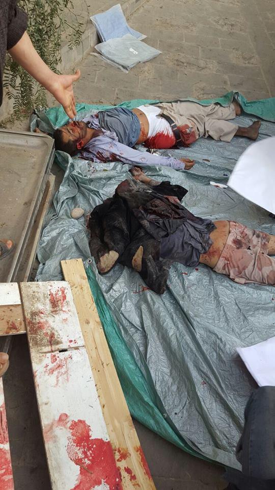 صور مروعة لحادثة قصف التحالف على مصنع عمران صور مروعة لحادثة قصف التحالف على مصنع عمران
