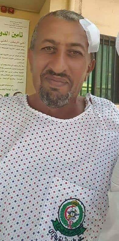 إصابة شقيق العميد حميد القشيبي في معارك ميدي (صورة)