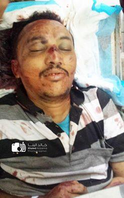 أول صورة للمصور الصحفي "محمد اليمني" بعد مقتله في جبهة الضباب بتعز وإصابة عدد من الإعلاميين