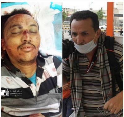 شاهد بالصورة: آخر منشور للمصور الصحفي "محمد اليمني" قبل مقتله في تعز
