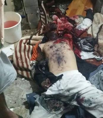 تفاصيل الانفجار الذي هز مطعم المنصور بشارع هائل يوم امس وسقوط قتلى وجرحى