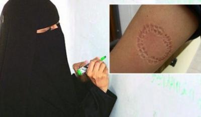 سعودية «تعض» زوجها وتجلده «بالعقال» وتويتر يشتعل حول هذه الحادثة