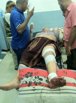 وكيل محافظة عدن "سلطان الشعيبي" يصيب نفسه بنفسه (تفاصيل + صورة)