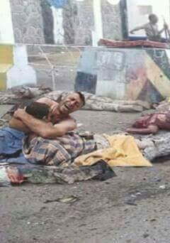 نشطاء يتداولون صورة مؤثرة لجريح في عدن يحتضن بقوة اخاه القتيل
