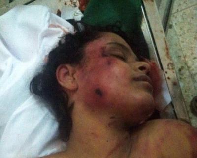 تفاصيل الجريمة التي هزت محافظة إب عامة و جبلة خاصة.. مصرع فتاة بعد تعذيبها بشكل وحشي من قبل خالها