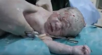 ما بعد الطفل عمران .. إنقاذ امرأة حامل وجنينها من الموت ببراميل الأسد المتفجرة ويصاب باصابات مختلفة (فيديو)
