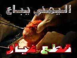 رد صادم من وزير الداخلية اليمني بشأن بيع اليمنيين اعضاءهم البشرية (الكلى) يجيز ذلك بهذا الشرط!