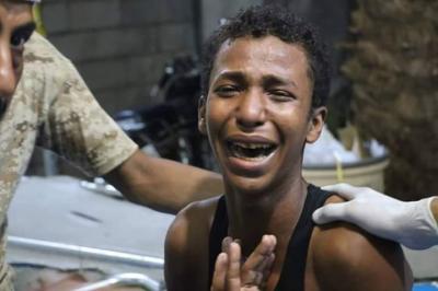 مقتل 22 مدنياً وإصابة أكثر من 90 في غارة جوية استهدفت حياً شعبياً في الحديدة