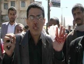 قناة البي بي سي تدين الاعتداء الخطير على مراسلها بصنعاء عبد الله غراب