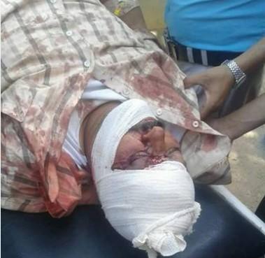 سقوط 4 قتلى و22 جريح بانفجار قنبلتين ألقاهما مسلح على سوق مزدحم شمال مدينة تعز