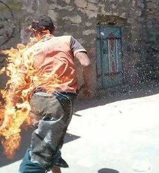 في جريمة بشعة بمحافظة إب.. مواطنون يحرقون شاباً ويصورونه بالكاميرا (صور)