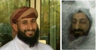 في ضربة موجعة للشرعية.. مقتل عدد من القيادات الميدانية (البارزة) في عدد من الجبهات (أسماء)