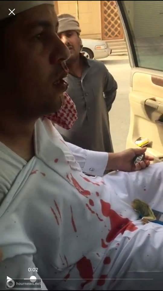 شاهد صور وفيديو: ردود افعال واسعة من اليمنيين والسعوديين على امير سعودي ضرب مغترب يمني حتى نزف دمه وسب امه الى قبرها