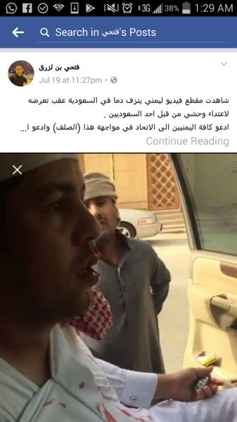 شاهد صور وفيديو: ردود افعال واسعة من اليمنيين والسعوديين على امير سعودي ضرب مغترب يمني حتى نزف دمه وسب امه الى قبرها شاهد صور وفيديو: ردود افعال واسعة من اليمنيين والسعوديين على امير سعودي ضرب مغترب يمني حتى نزف دمه وسب امه الى قبرها