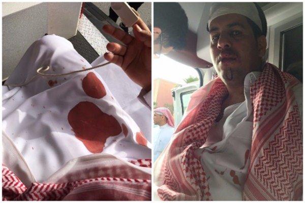 المغترب اليمني «جمال سنان» يكشف تفاصيل واقعة إعتداء الأمير السعودي عليه 