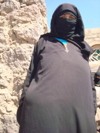 ناشدت فاعلي الخير مساعدتها بالعلاج:  يمنيه تعاني مأساتين:آلام ورم متضخم بجسدها منذ عام،،وعدم وجود عائل يتبنى علاجها