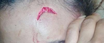 زوجة أكبر رؤساء العالم ضَبطت عارضة أزياء في غرفة ابنيها الاثنين بالفندق ففعلت ما لا يمكن توقُّعه