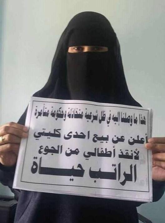 في صورة صادمة للشرعية: ثائرة تعز تعرض كليتها للبيع لإطعام أطفالها
