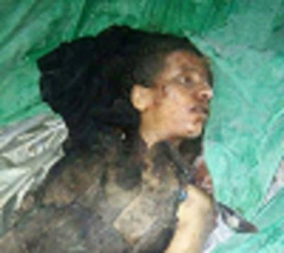 أمن محافظة إب يتعرف على هوية الفتاة المقتولة حرقاً وتعذيبا داخل بئر